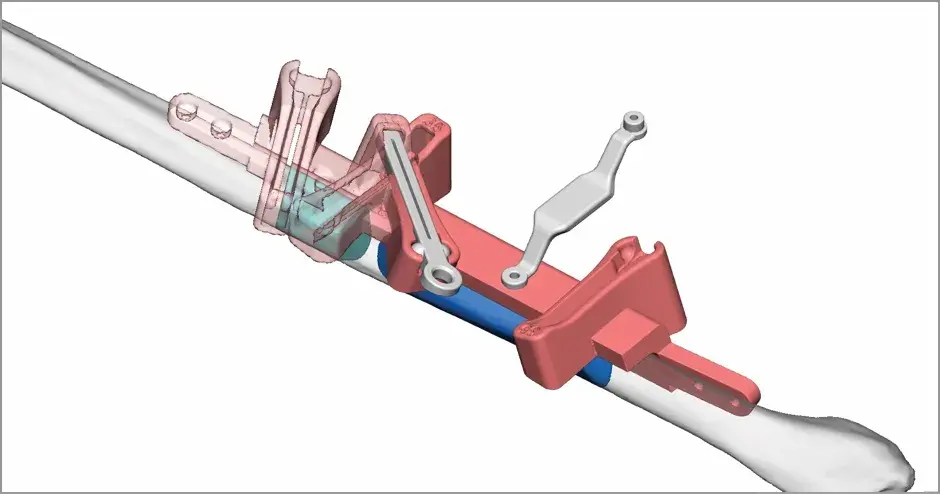VSP - 仮想外科手術計画