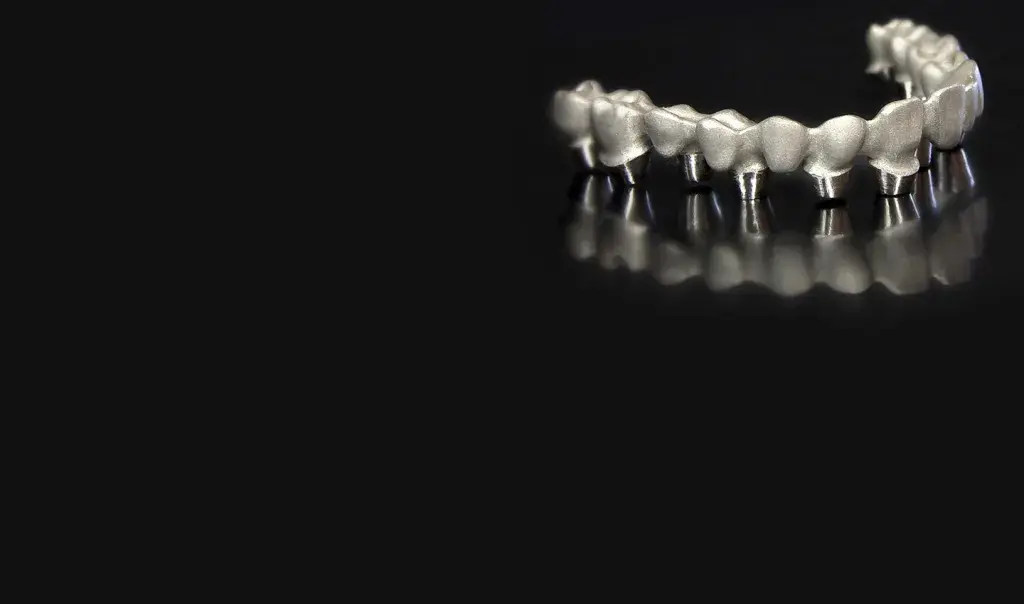 Customer Story Direct Metal 3D Printing Brings Growth Benefits to MicroDent Dental Lab top banner