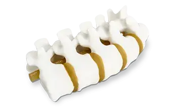 3D Systems による 3D プリント脊椎人体モデル