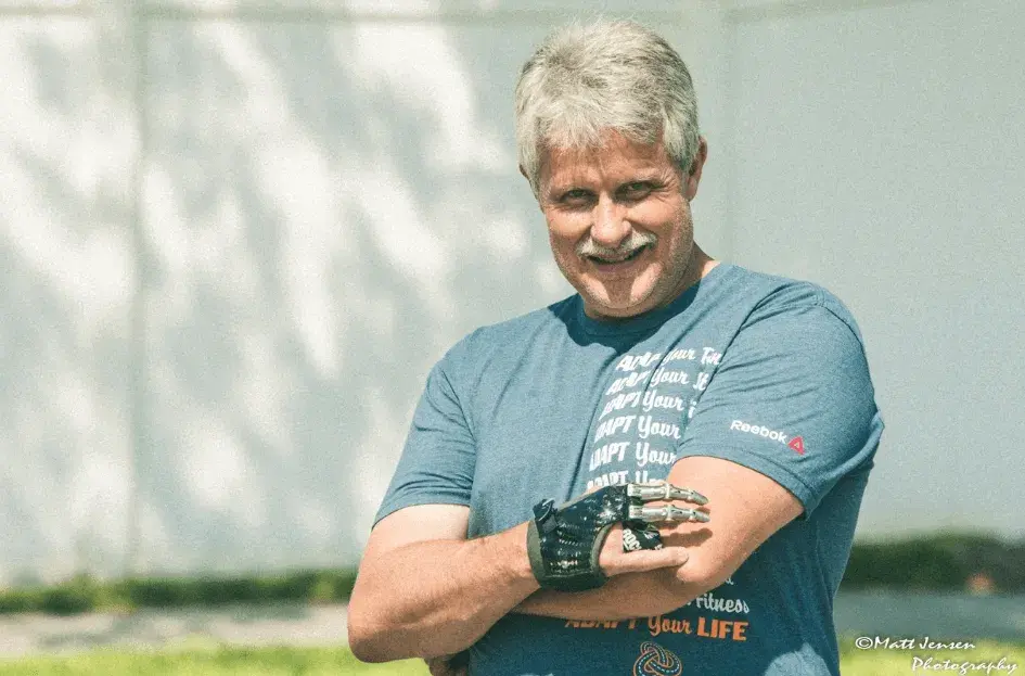 ポイント・デザインズ社の部分義手を装着したジェフ・ソエルバーグ氏