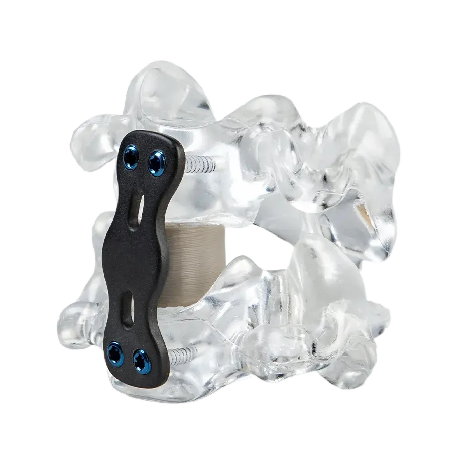 3D printed spinal cage device in PEEK for spinal surgeries 