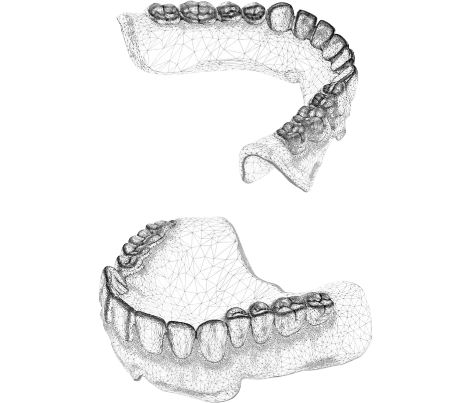 NextDentプロダクションCADファイル