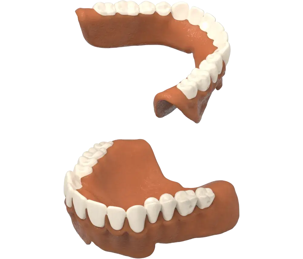 NextDentプロダクションワックスが取り除かれました