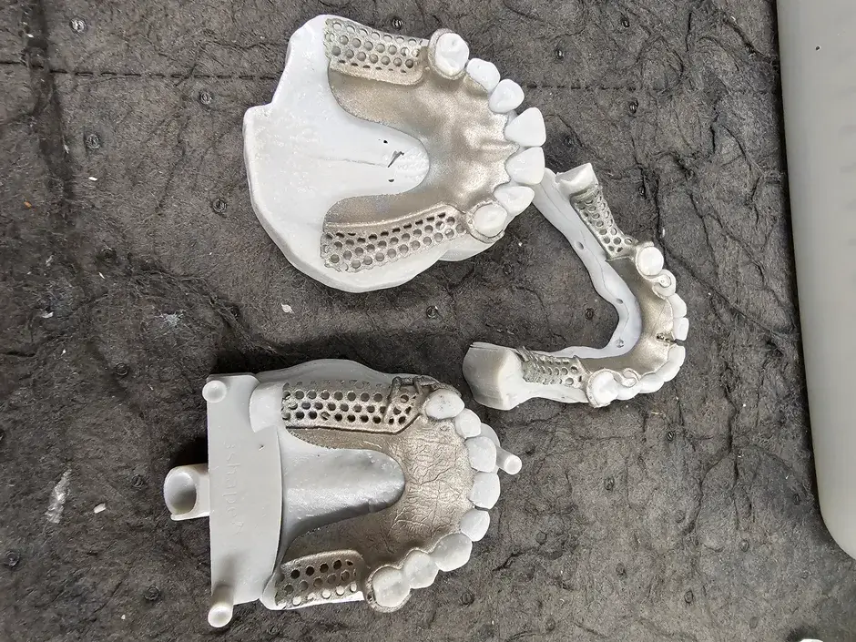GPS Digital RPD Dentures