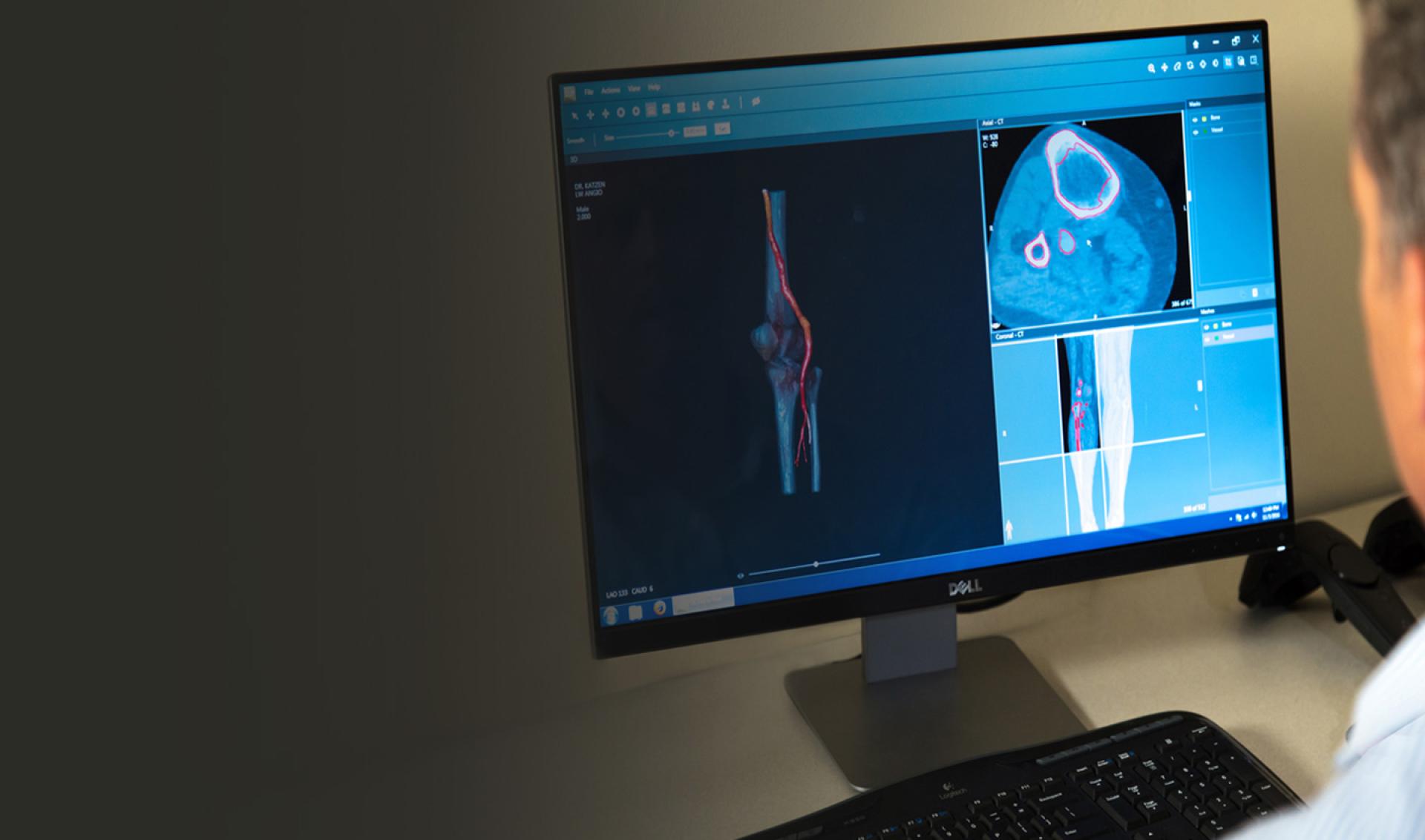 D2p Dicom To Print 3d Systems D2p Dicom To Print 3d Systems